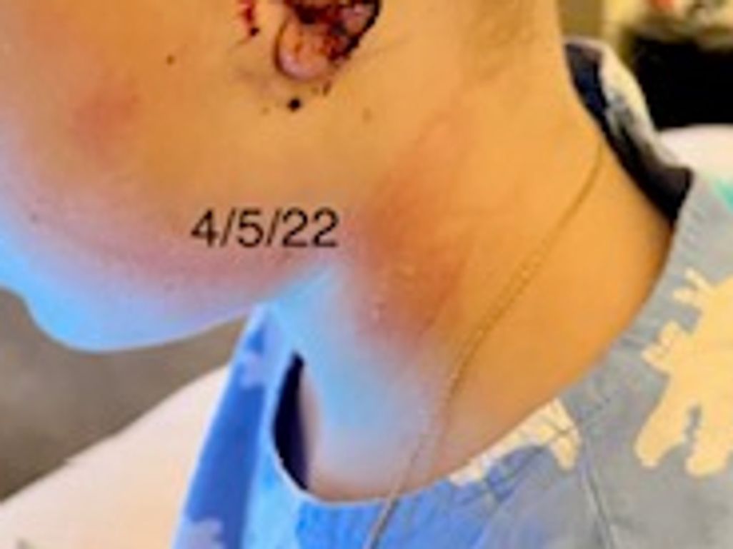 We Have an Ear Lobe!