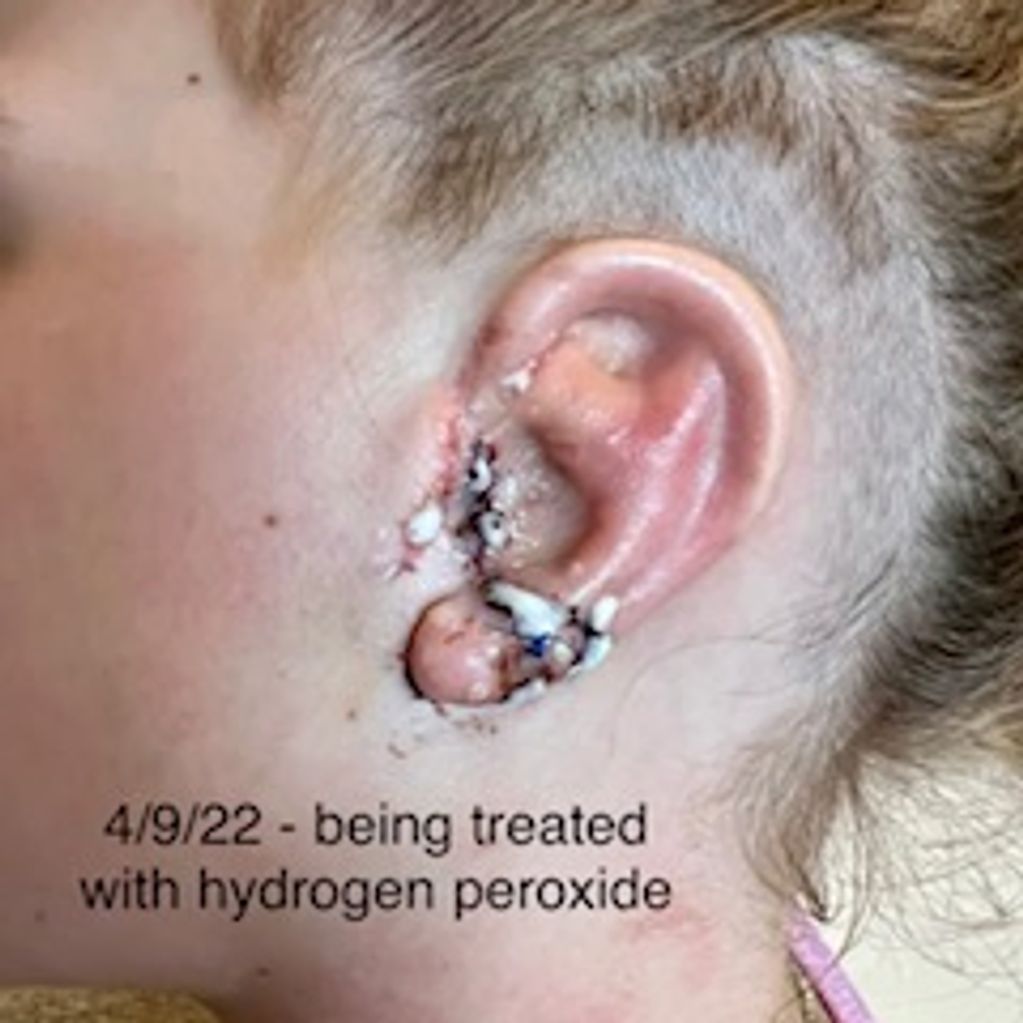 4/9/22 - Hydrogen Peroxide