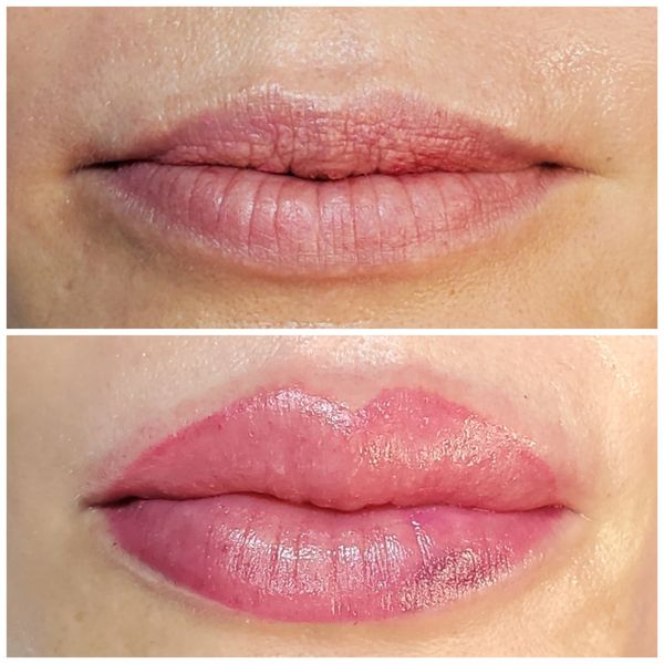 Permanent Cosmetic Lip Blush 