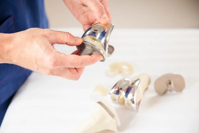 Dr. Alexey Borshch Total knee replacement components