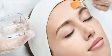 SkinWithin chemical peels