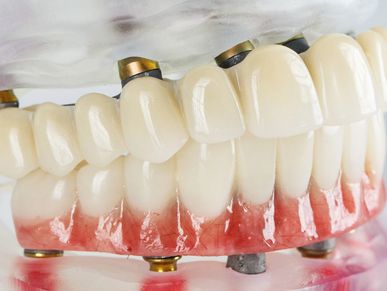 Mark Chandler Denturist in Etobicoke. Full Dentures, Partial Dentures and Denture Implants. Call now