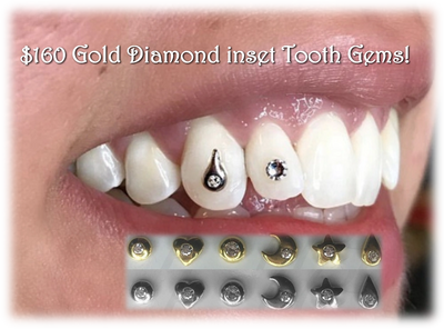 alt-gold-tooth-gems