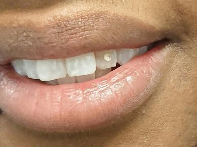 alt-swarovski-genuine-tooth-crystals