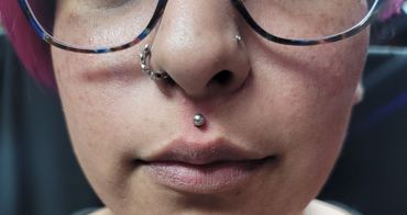 Medusa piercing