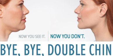 WE offer the Kybella procedure.  Kybella is a nonsurgical injectable technique used to target the fa