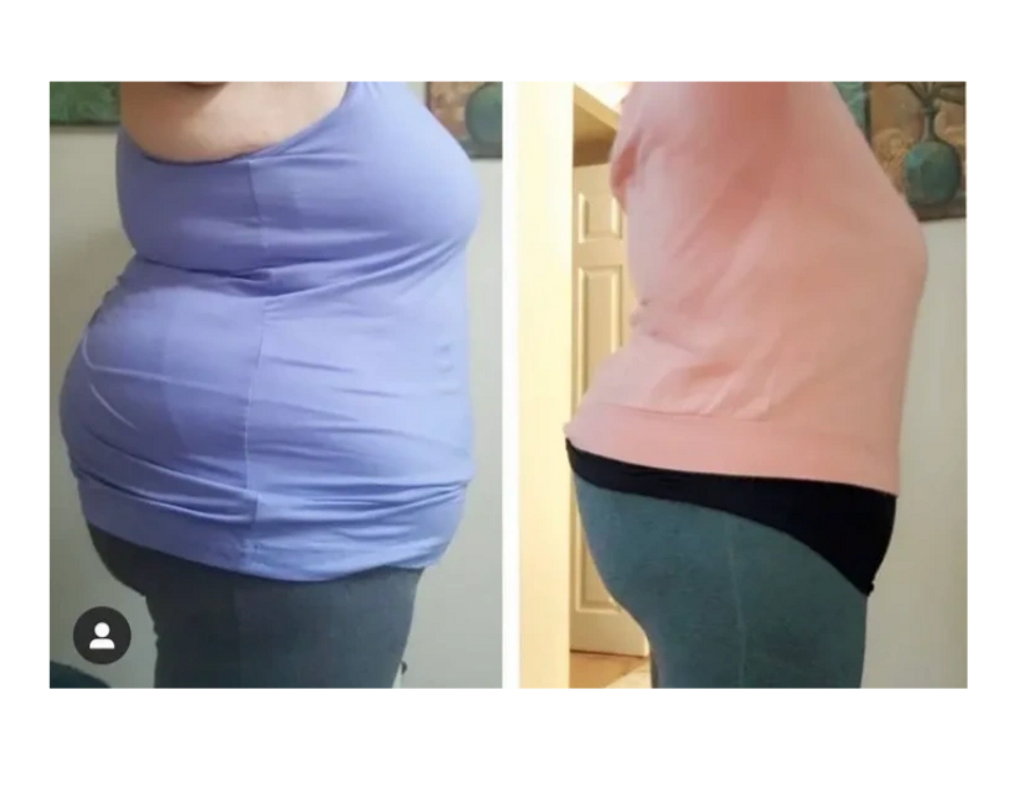 Nava Singer - Patient Testimony