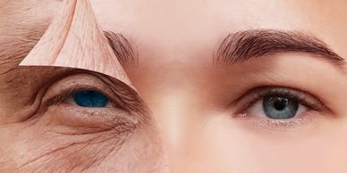 Skin Regeneration