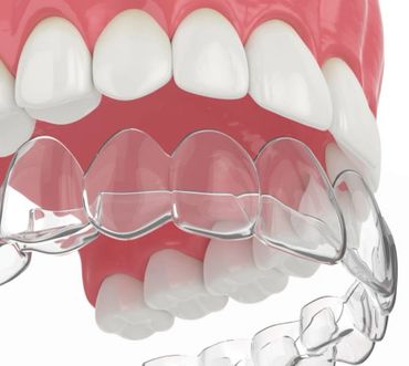 şeffaf plak ortodonti tedavileri