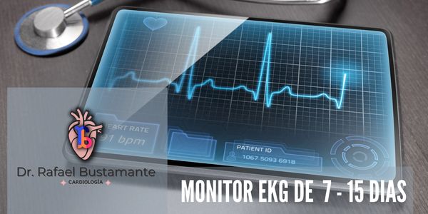 Monitoria de electrocardiografia continua de 7 o 15 días con dispositivo pequeño y facil de llevar