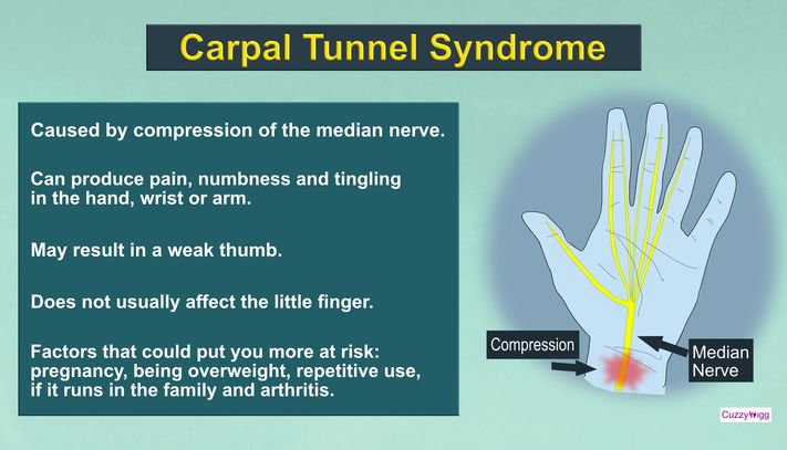 Carpal Tunnel Syndrome. Cuzzywigg Lifestyle