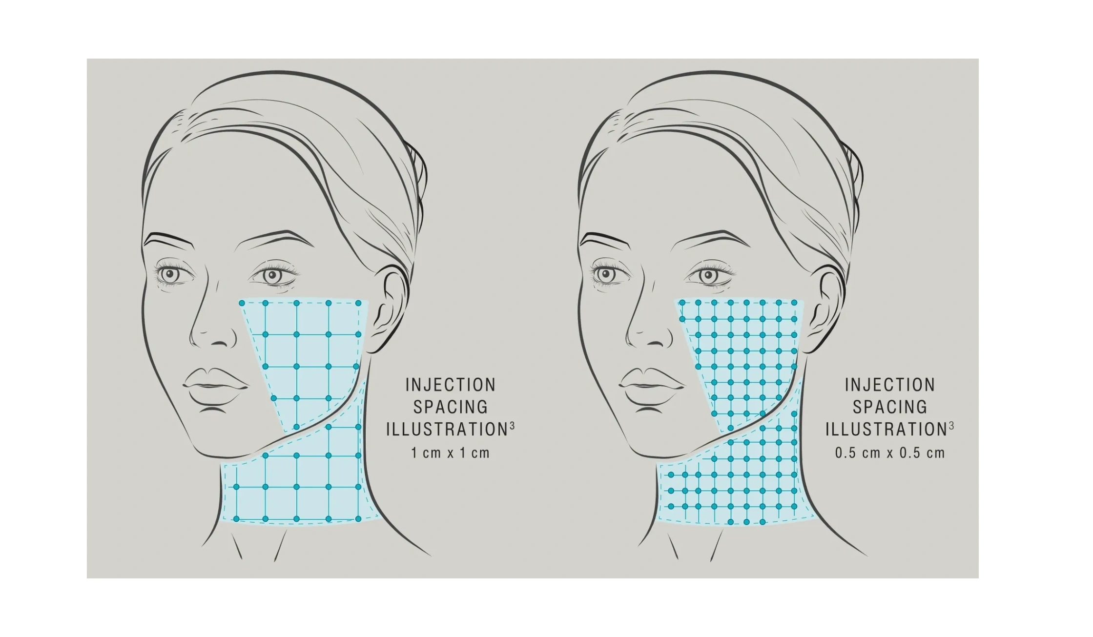 Vancouver Botox Clinic, by Dr. Ward. Botox, Juvederm Fillers, CoolSculpting, SkinMedica, Skinvive.