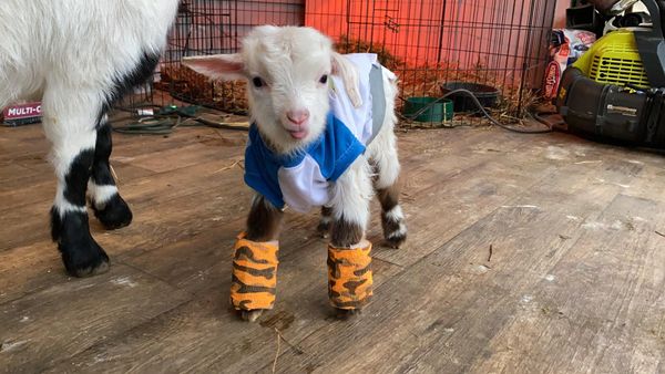 Baby Max in his splints to treat contracted tendons in his legs.
