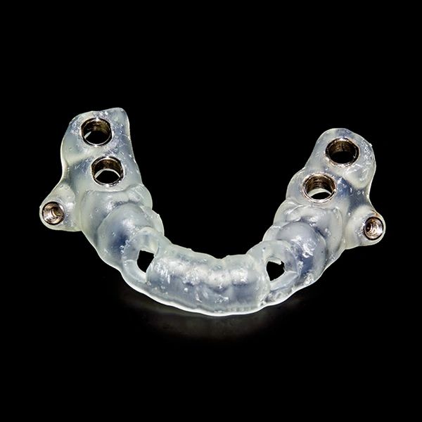 Transparent dental surgical guide with metal inserts on a black background.