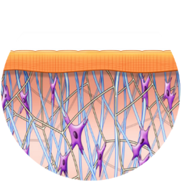 After exilis treatment