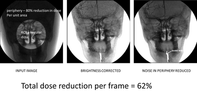 Region of Interest Imaging