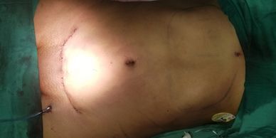 cirugia plastica
cirujano plástico
Clínica estética 
lipoescultura
abdominoplastia
SPA medico