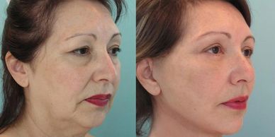 CIRUJANO PLÁSTICO 
CLÍNICA ESTÉTICA 
DERMATÓLOGO
limpieza facial
manchas
acné
hidratación facial
SPA