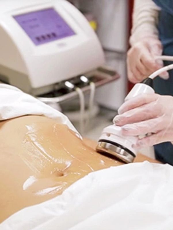 Body sculpting
belly fat removal without surgery
cellulite treatment
non-surgical contouring 