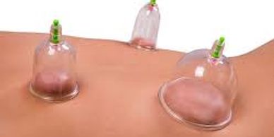 Cupping Massage Therapy