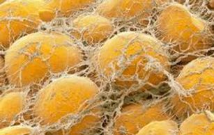 The number of fat cells don't change from birth to death only the inflation of them.
