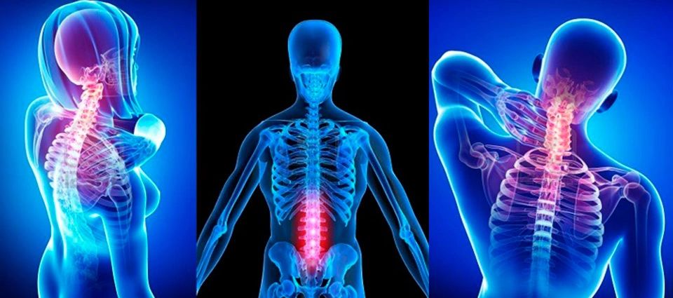 X-ray images highlighting spine pain in different regions.
