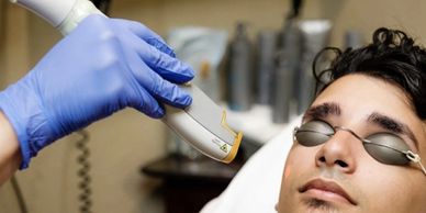 laser hair removal being done on a mans face
