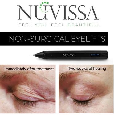 fibroblast plasma current skin rejuvination on the eyelid
