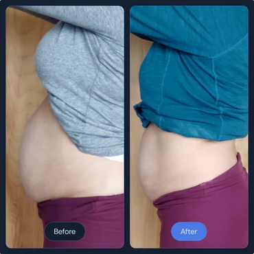 Cryoslimming at CryoStrong Toronto in Markham how it works before and after.