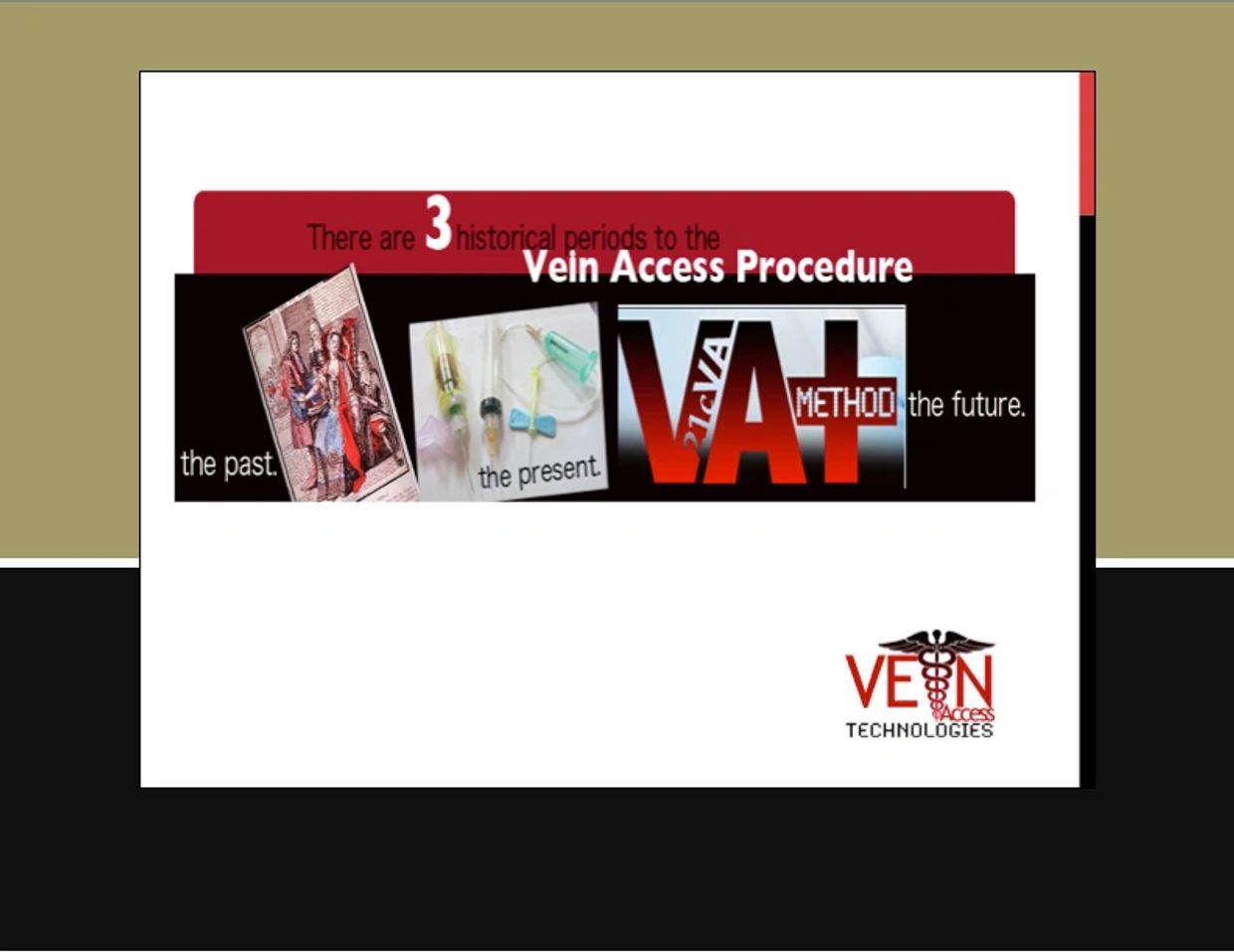 There are 3 historical eras to Vein Access:
bloodletting, 'phlebotomy', & STEM 21cVA venipuncture.