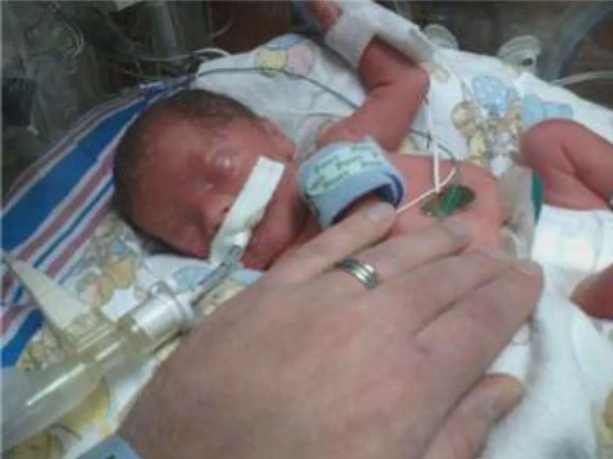 Josiah Fogleman in the NICU. The inspiration for this project.