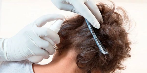 Our lice clinics are equipped to remove all lice in one hour treatment. 100% Lice removal guarantee.