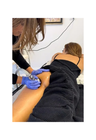 Vacuum Therapy- Boity Lift