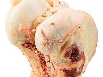 Close-up of a diseased human knee joint with visible damage and lesions.