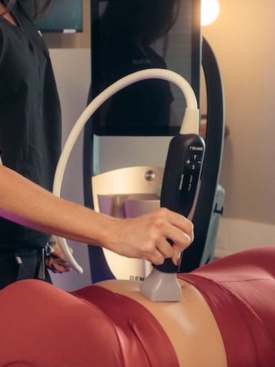Laser Treatment