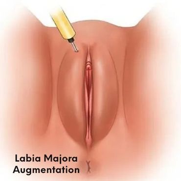 تكبير الشفرتين الكبيرتين