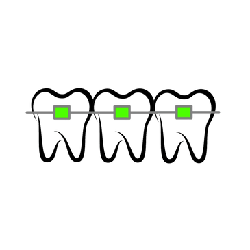 Braces Atlas Smiles Dental