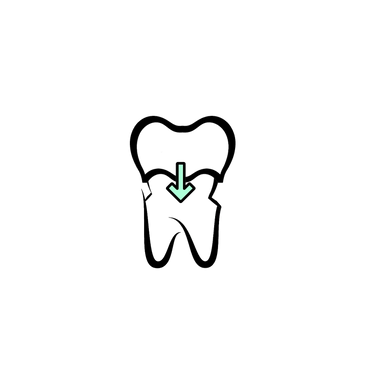 Dental Crowns Atlas Smiles Dental