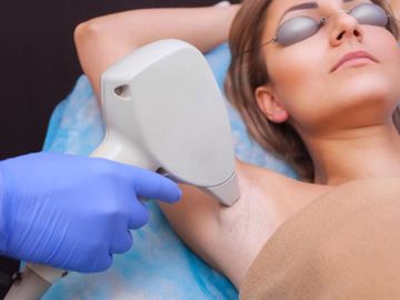 laser hair removal south florida
