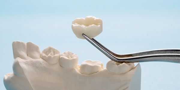 closeup image of  single teeth crown and bridge equipment model express fix restoration