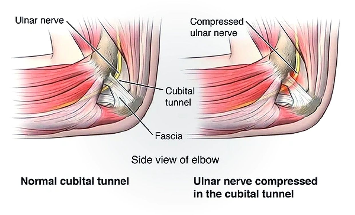 Cubital tunnel anatomy