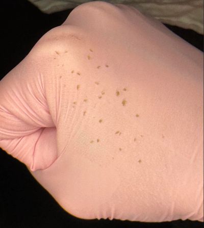 Learn which skincare, makeup and haircare ingredients may contribute to clogged pores and breakouts.