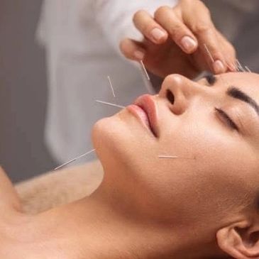 ACUPUNCTURE
A traditional Chinese practice, Acupuncture stimulates sensory nerv