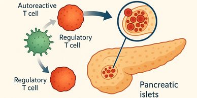 Illustration of autoreactive and regulatory T cells affecting pancreatic islets in type 1 diabetes.