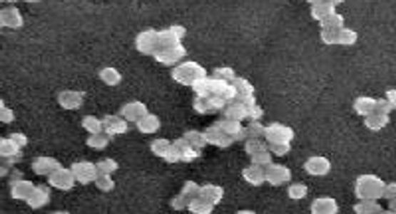 Ceramic Nanopowders