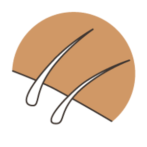 AGEs impact on the skin