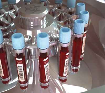 Blood test tubes in a centrifuge for laboratory analysis.