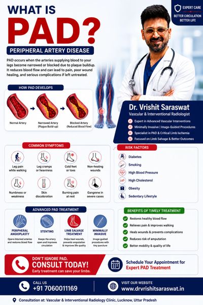 Peripheral artery disease treatment in Lucknow
PAD angioplasty procedure
Blocked leg artery treatmen