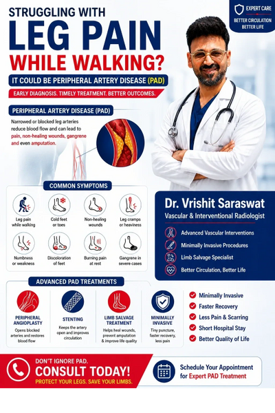 Peripheral artery disease treatment in Lucknow
PAD angioplasty procedure
Blocked leg artery treatmen