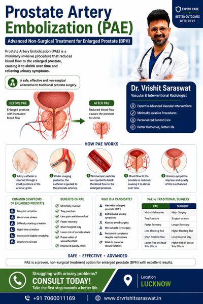 Prostate artery embolization procedure
Enlarged prostate treatment in Lucknow
PAE treatment by Dr. V